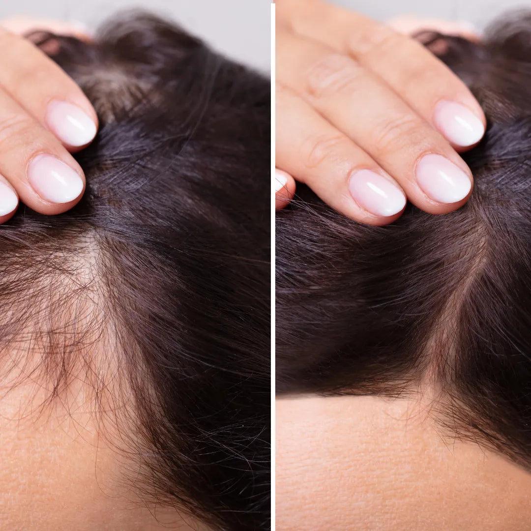 Cosmetific™ GlowRoll Castor Oil