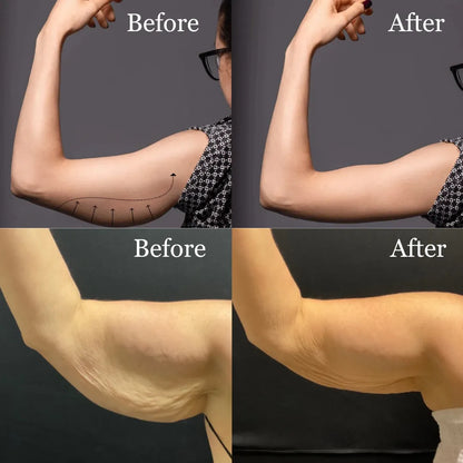 Cosmetific™ GlowShape Arm Cream