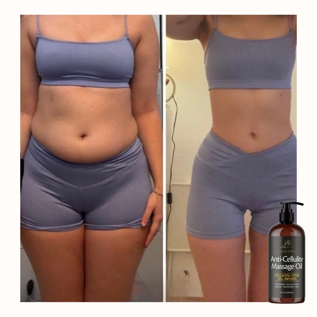 Cosmetific™ Anti-Cellulite Massage Oil