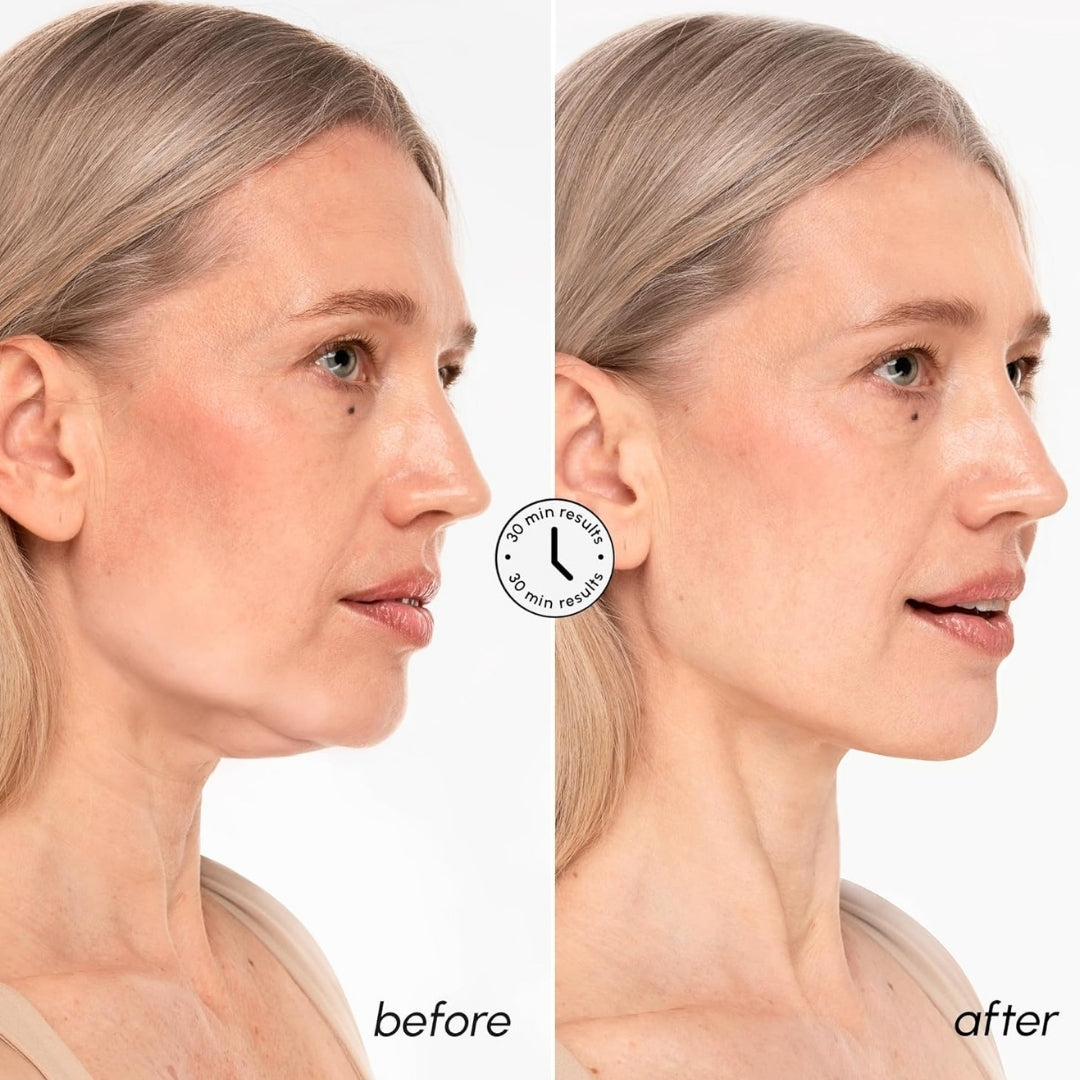 Cosmetific™ FaceLifter