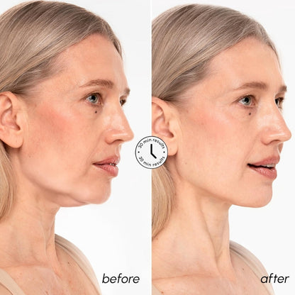 Cosmetific™ FaceLifter